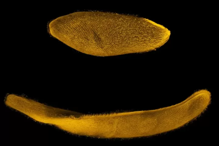 Siyah zemin üzerinde altın sarısı renkte görüntülenen Spirostomum ambiguum, üstte büzülmüş ve altta uzamış biçimde görülüyor.